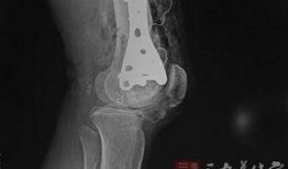 伴侣愈合高清在线观看,高清在线观看，情感疗愈之旅